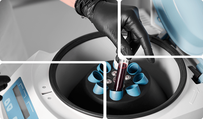 a person is putting a blood sample into a machine