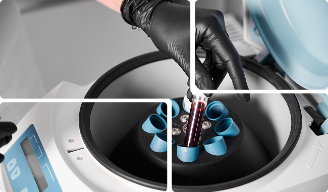 a person is putting a blood sample into a machine